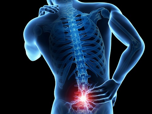 cum să scapi de durerile de spate și de coloană vertebrală